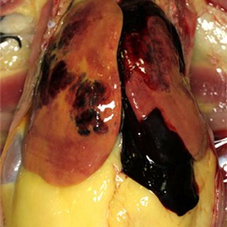 Fatty Liver Hemorrhagic Syndrome